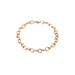 Chunky Anklets